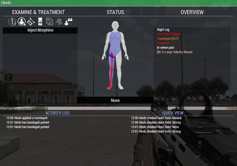 med_aid_fracture.jpg med_aid_fracture.jpg